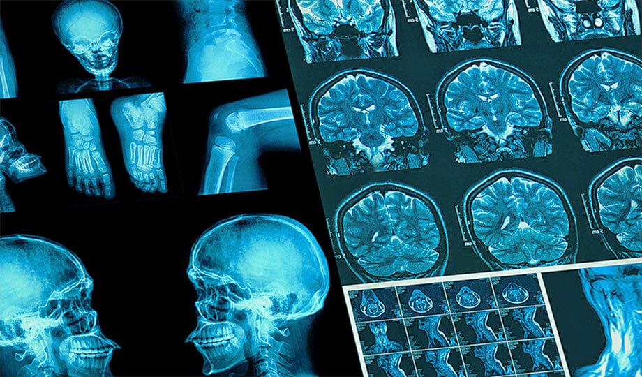 Radiologische Aufnahme einer MRT farbige Abbildung: MRT-Aufnahmen veranschaulichen wichtige Patienten-Informationen